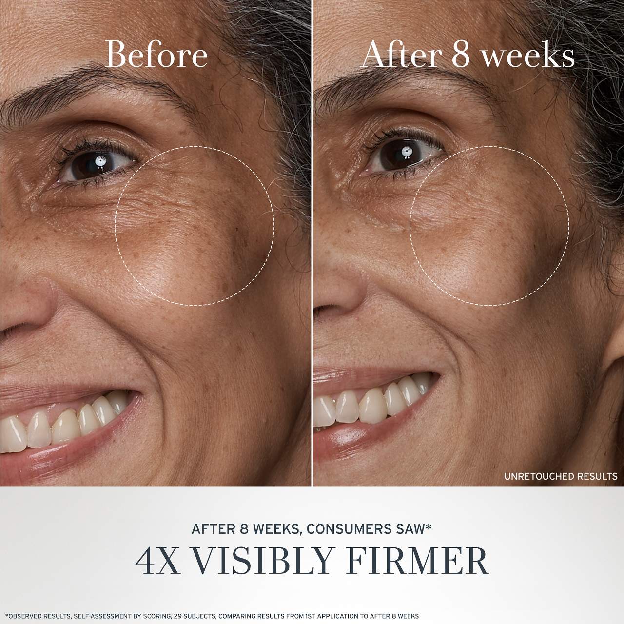 Black Tea Antiaging Moisturizer With Retinolalternative Bt Matrix