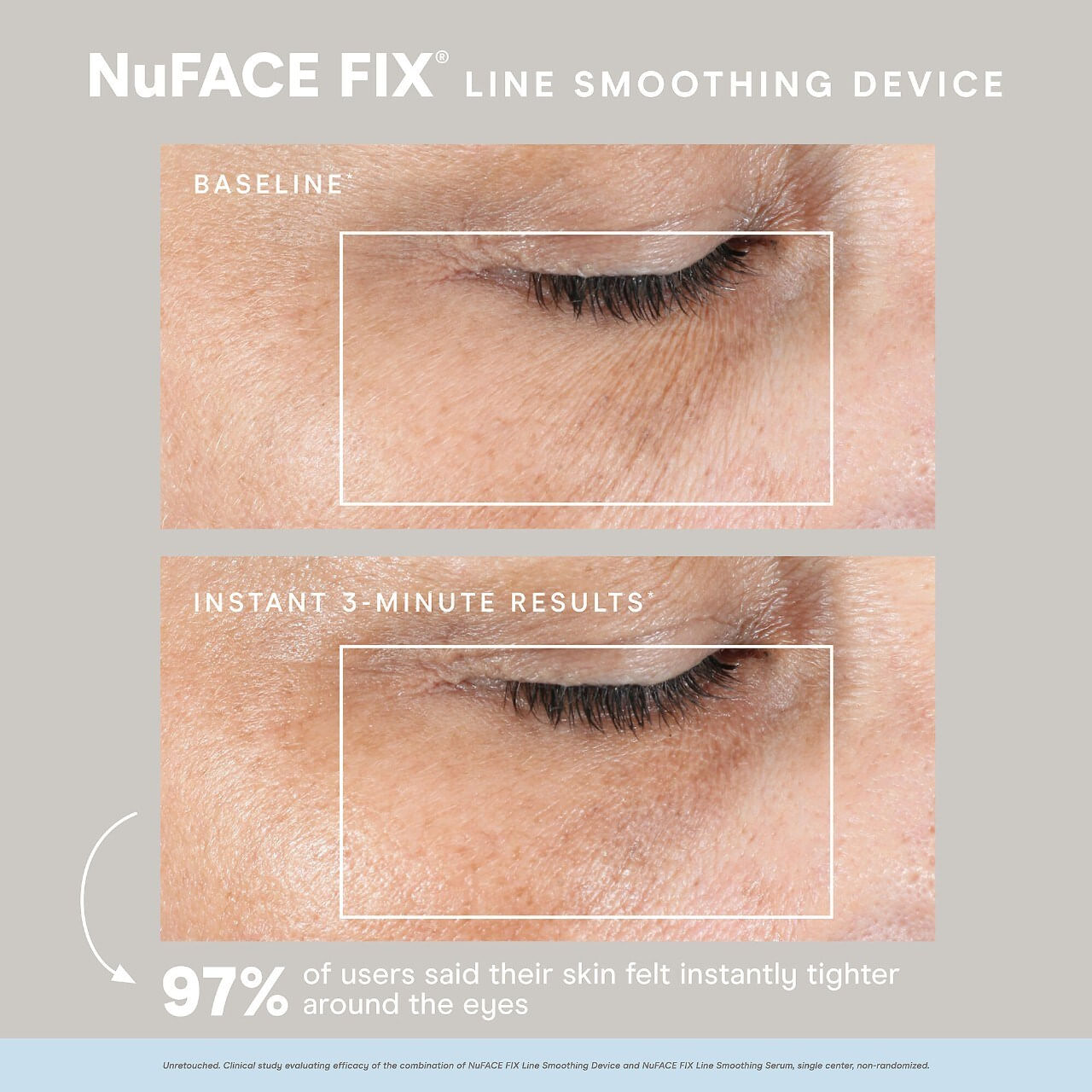 Nuface sale FIX Line Smoothing Device