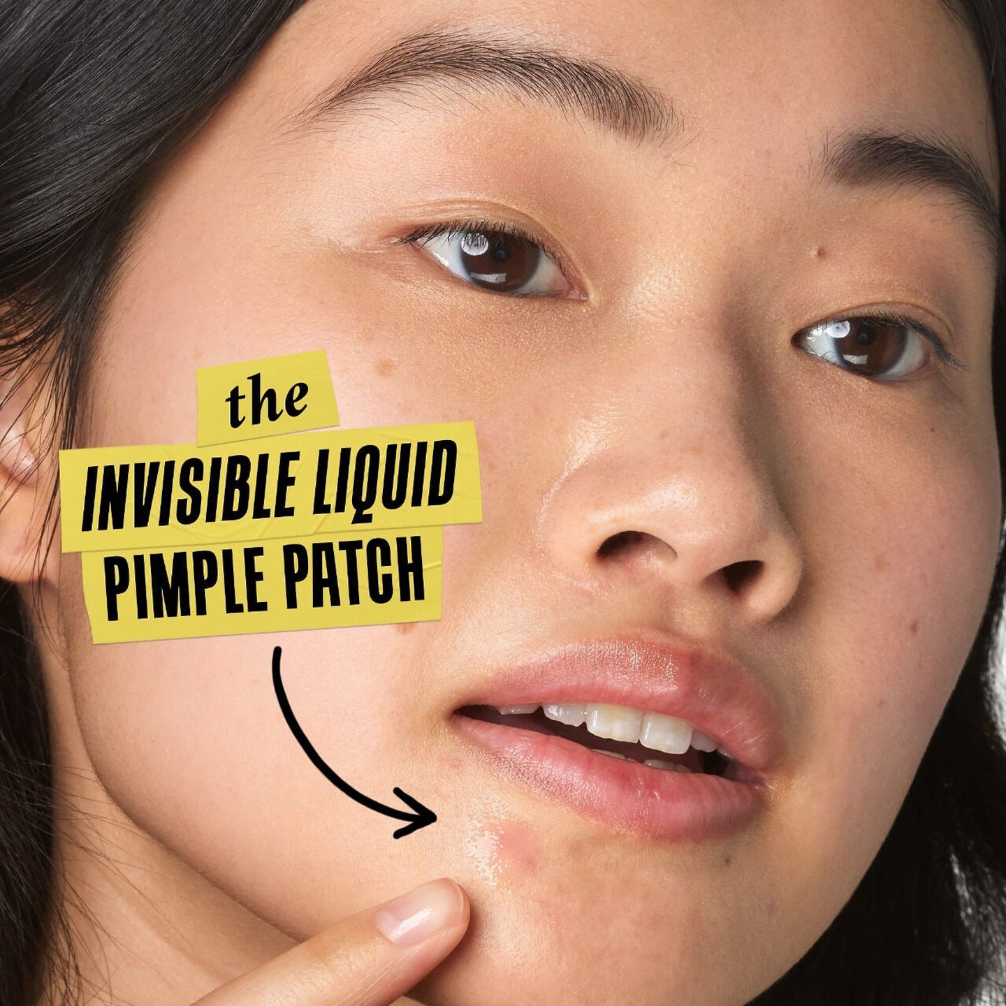 宅配便配送 Truly Targeted Acne-clearing Salicylic Acid Pimple Patch 美容液