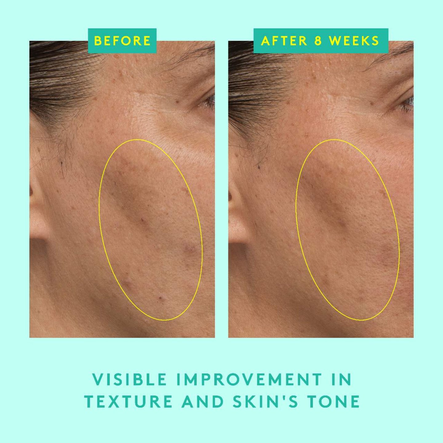 Protini™ Powerpeptide Resurfacing Serum With Lactic Acid