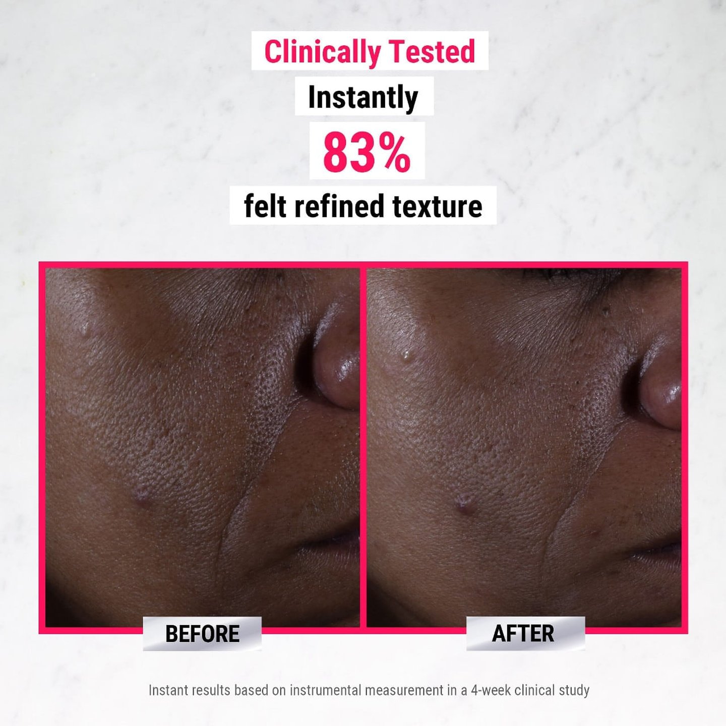 Ultra Pure High-potency 9.8% Glycolic Acid Serum | Women's